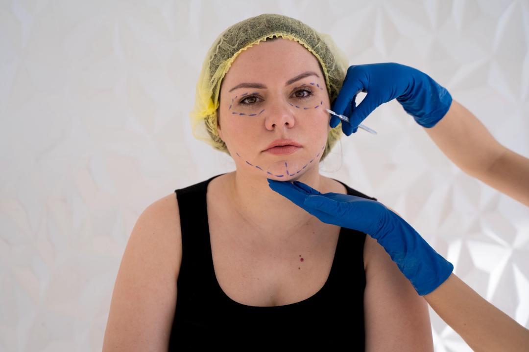 PLASTIC AND RECONSTRUCTIVE SURGERY